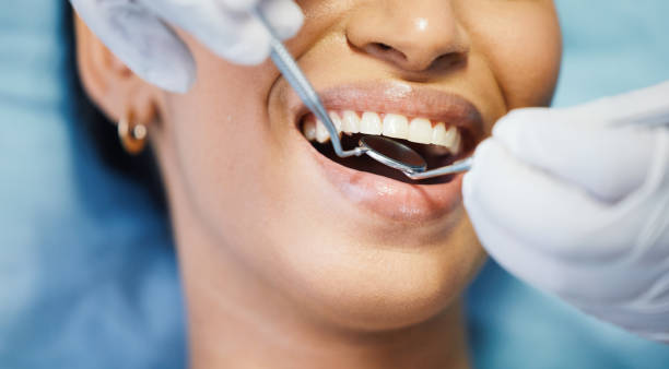 Best Urgent Care for Lost Fillings or Crowns in La Honda, CA